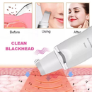 Aparelho de Peeling Esfoliante Ultrassônico Limpeza Facial Profunda Remoção de Cravos Antirrugas